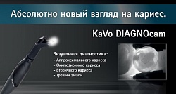 Диагнокам - современная диагностика кариеса